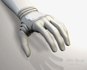 Michelangelo-Hand (©Otto Bock)