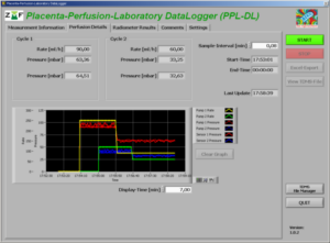 Software zur Datenerfassung für das Plazenta-Perfusionslabor (Bild: BEKO)