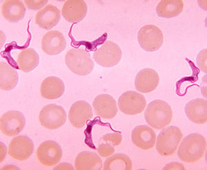 Parasit Trypanosoma: Bewegung analysiert (Foto: CDC/Dr. Myron G. Schultz)