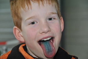 Blaue Zunge: Verbindung zum Gehirn nachgewiesen (Foto: pixelio.de, Paulwip)