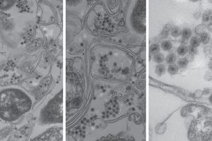 Virenbefallene Bakterien unter dem Elektronenmikroskop (Foto: web.mit.edu)