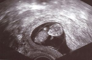 Im Mutterleib: Sauerstoffmangel hat gravierende Folgen (Foto: pixelio.de, Arzt)