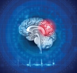 Neues Headset der UCSF verhindert Spätfolgen für das Gehirn (Bild: mindrhythm.com)