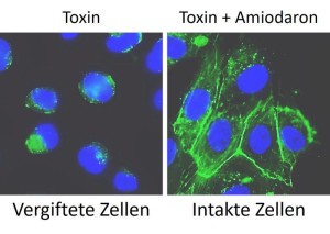 Vergiftete Zellen (links) und Zellen, die mit Amiodaron behandelt wurden (Fotos: uni-ulm.de)