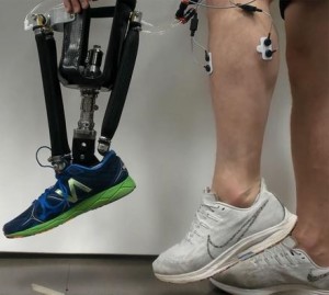 Unterschenkelprothese, die von Gedanken gesteuert wird (Foto: Aaron Fleming, ncsu.edu)
