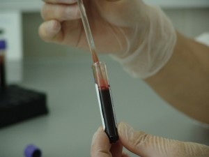 Bluttest: Dieser reicht zur Überprüfung der Behandlung aus (Foto: pixabay.com, PublicDomainPictures)