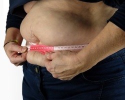 Übergewicht: Diät und Sport reichen oft nicht mehr aus (Foto: pixabay.com, Bruno)