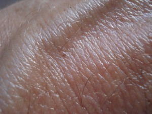 Haut: Tool macht KI-gestützte Krebsdiagnosen für Ärzte transparenter (Foto: pixabay.com, Beeki)