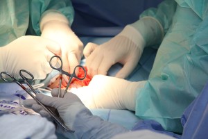 OP: Eingriffe werden meistens von Chirurgen durchgeführt (Foto: pixabay.com, Debora Alves)