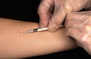 TBC-Impfung: Infektion verursacht zahlreiche Todesopfer (Foto: pixabay.com, Wikilmages)